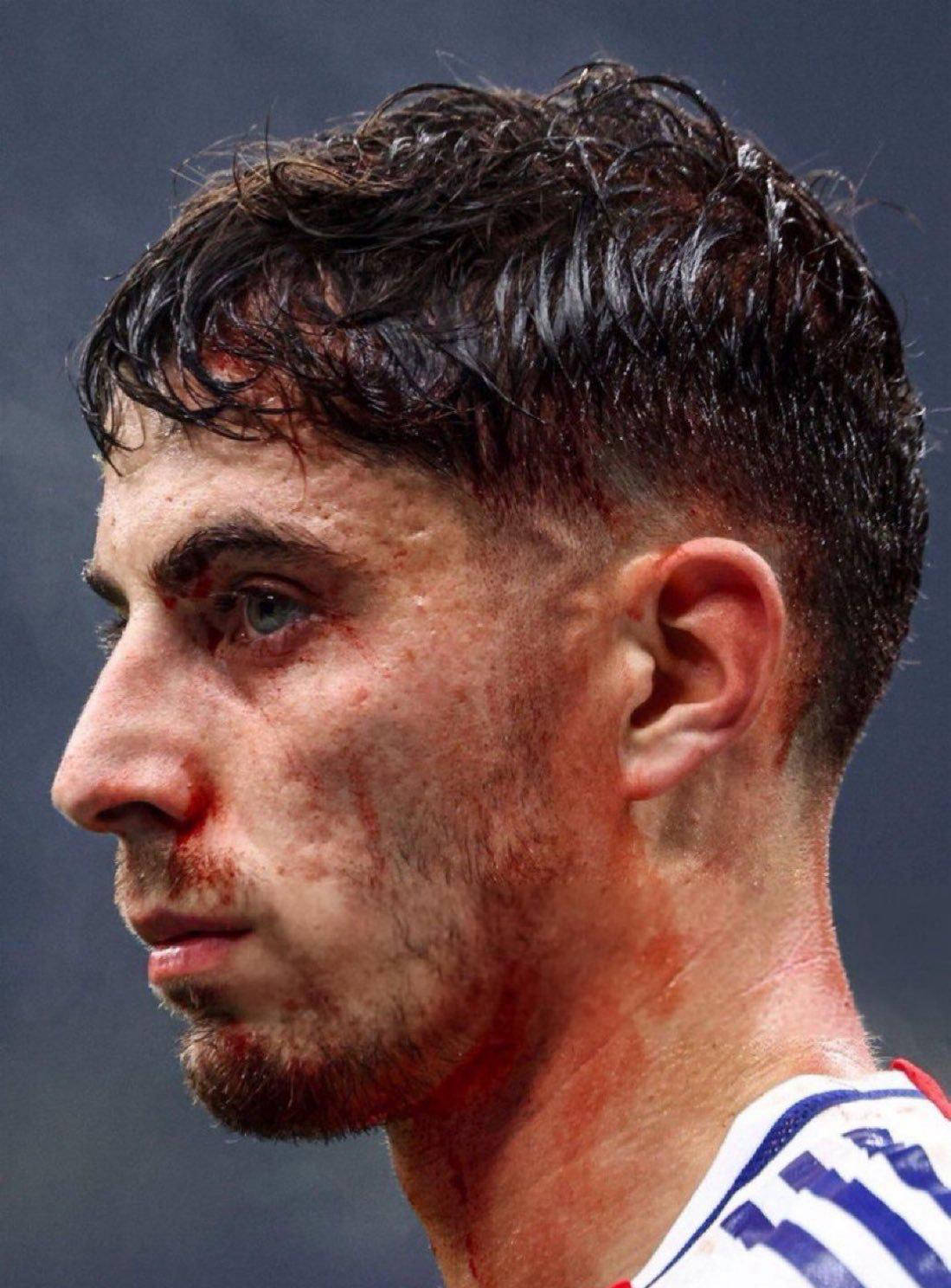 开云体育中国-阿森纳主帅不满球员表现，加强严苛训练